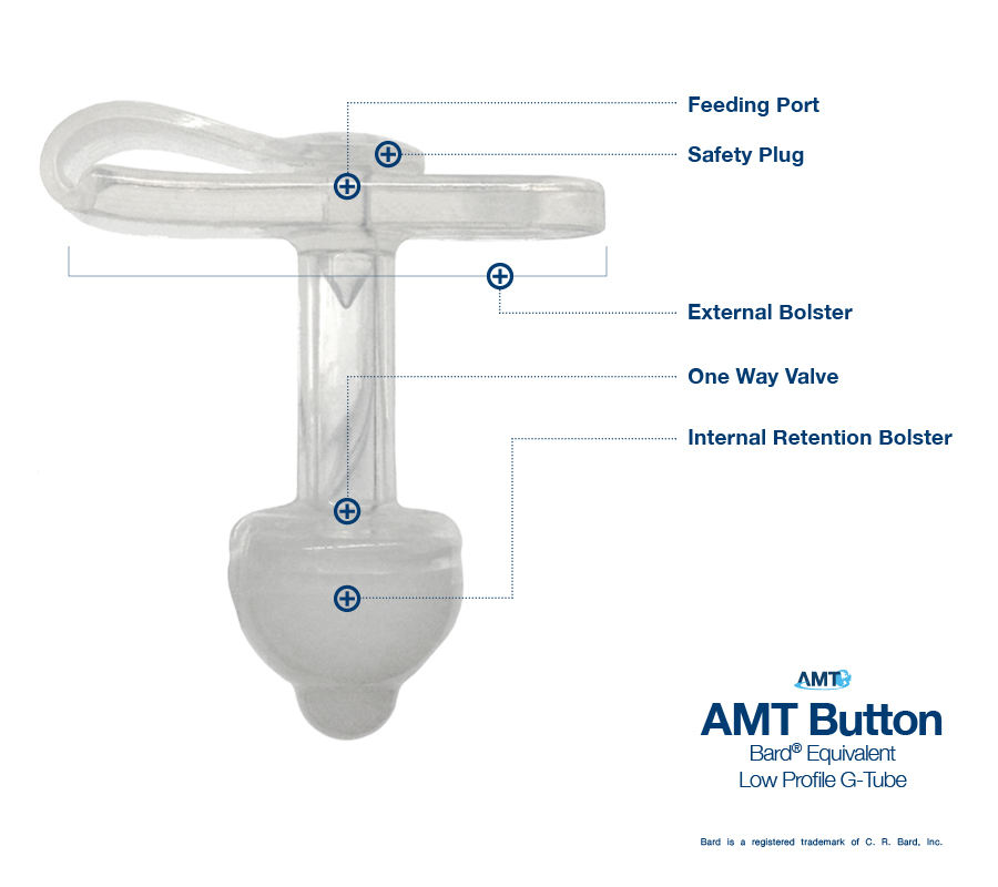 G tube. Feed button. Button g. External Plug.