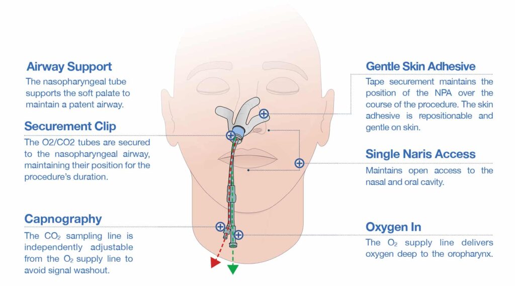 Applied Medical Technology|IntelAir™