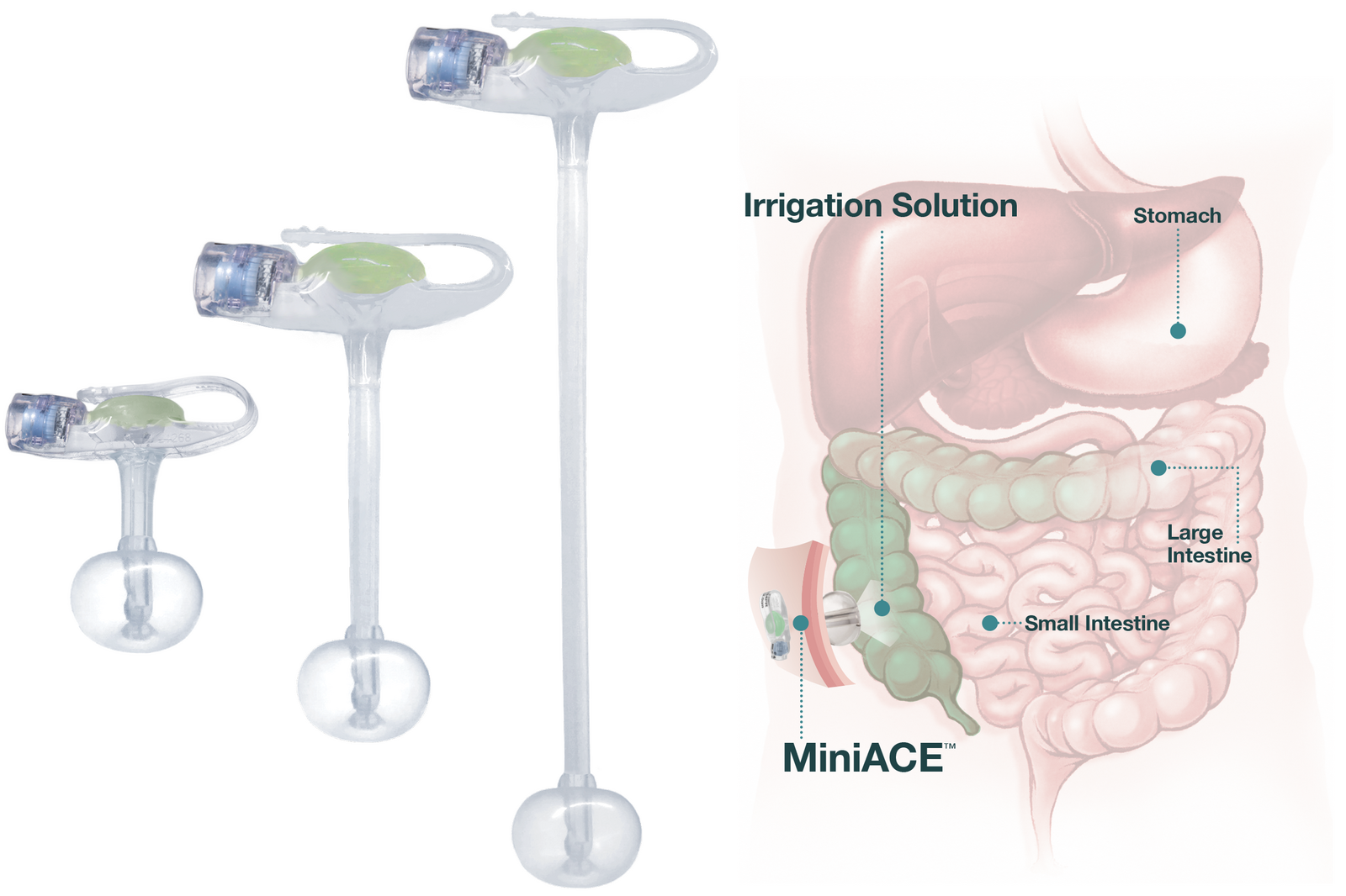 New to bowel management?