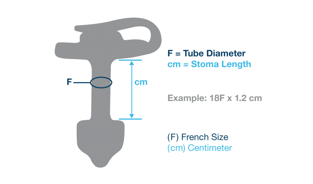 Applied Medical Technology|AMT Button G-Tube