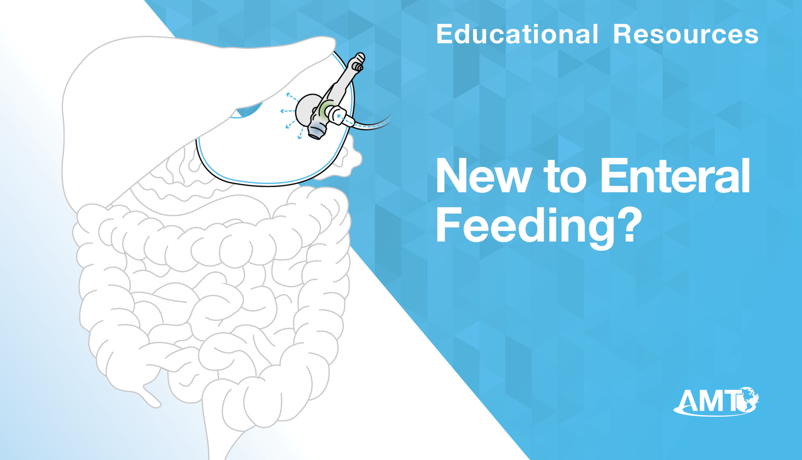 New to enteral feeding?